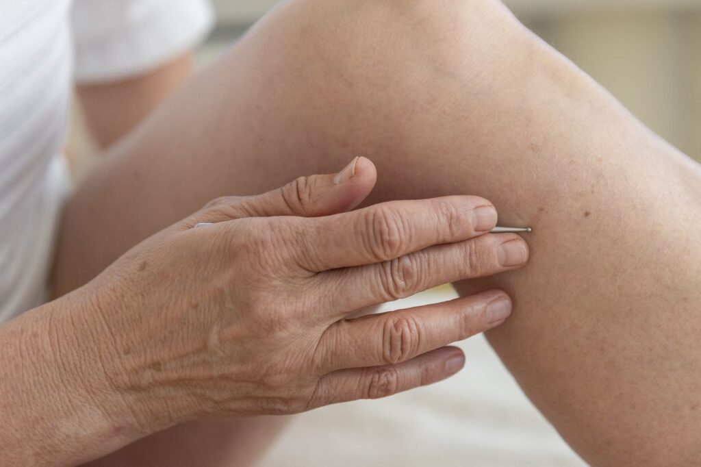 physioapm 2026 apm emdr boeger therapie 41